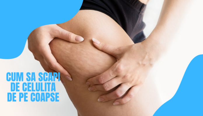 Cum sa scapi de celulita de pe coapse