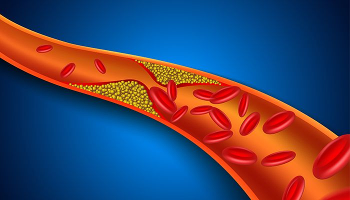 Trigliceridele: motiv de ingrijorare sau nu? 8