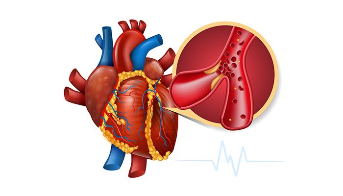 Trigliceridele: motiv de ingrijorare sau nu? 9