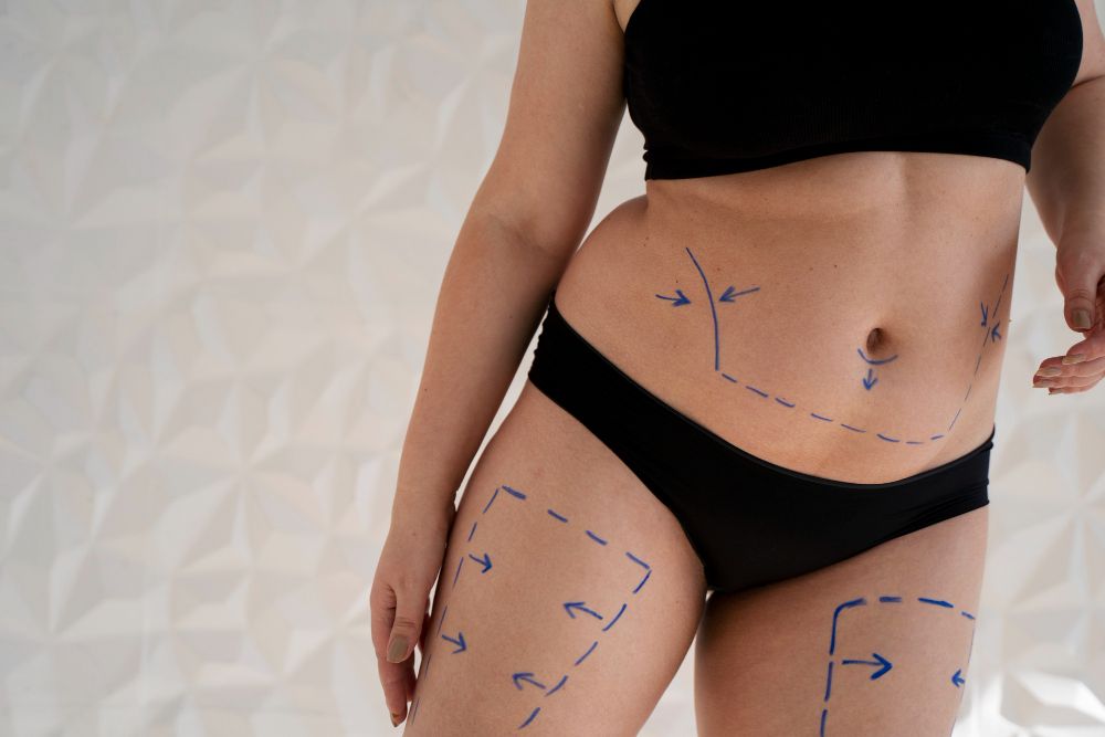 Slabirea localizata: mit sau realitate? 2 Slabirea localizata: mit sau realitate? 2