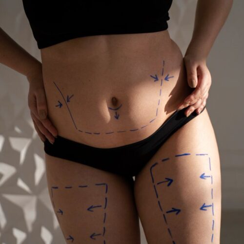 Slabirea localizata: mit sau realitate?